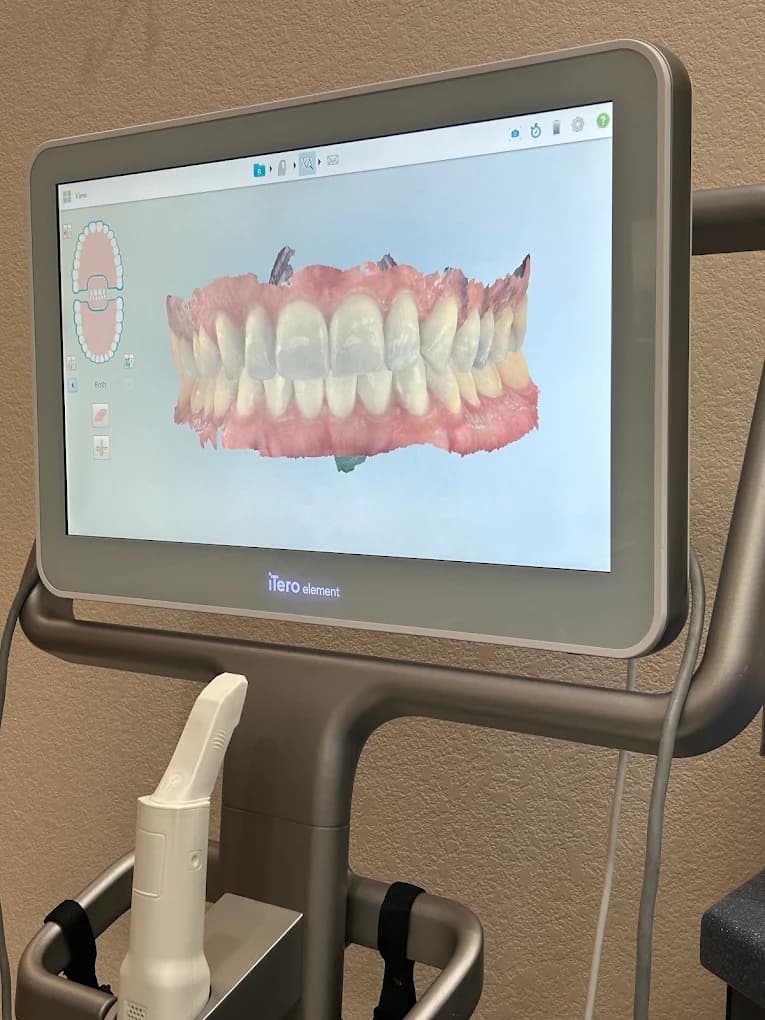 A digital dental scan displayed on the practice scanner